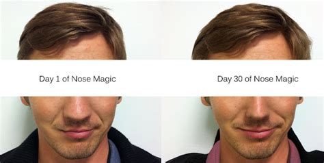 magic nose shaer results